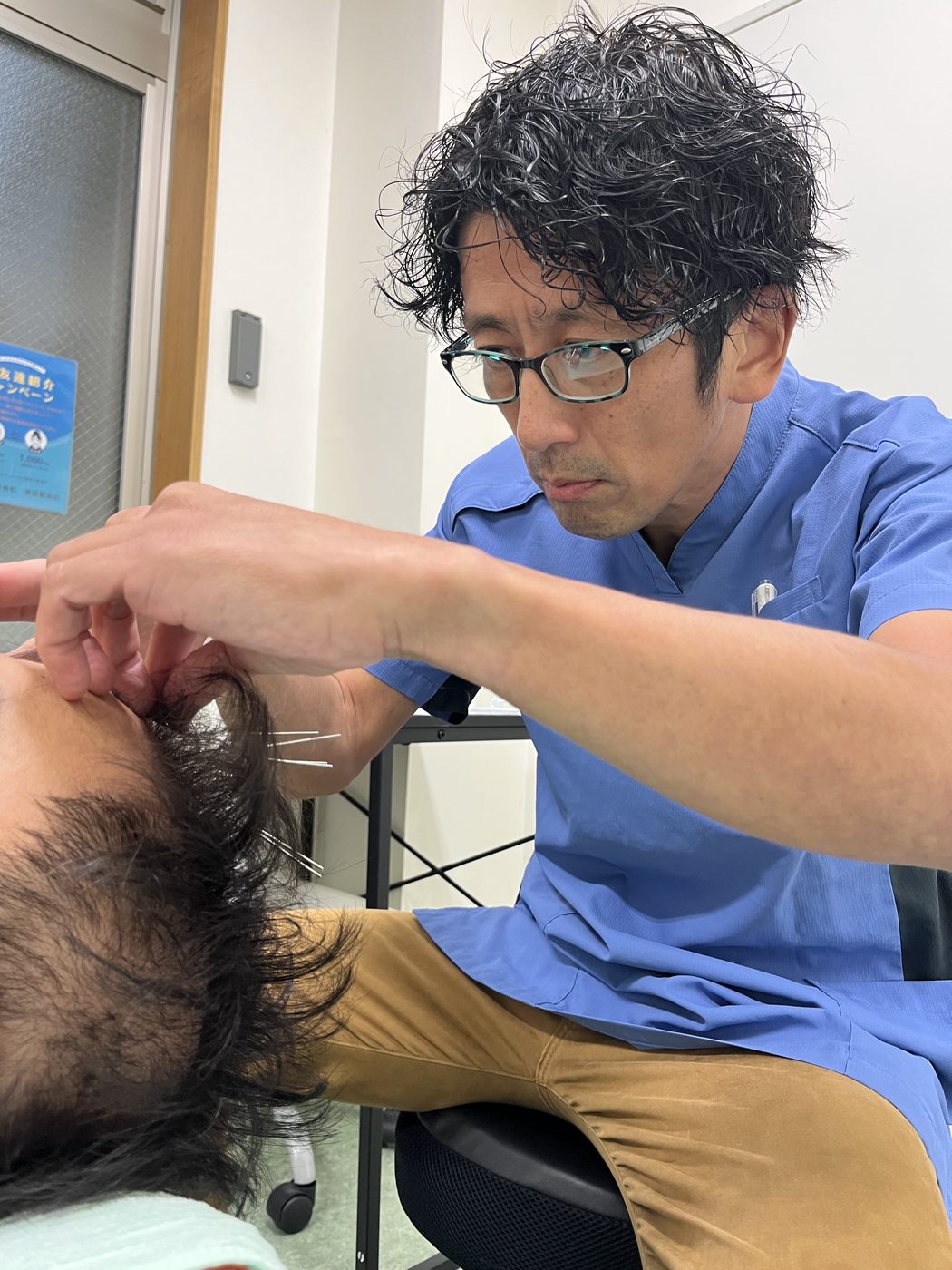 頭皮に細い鍼で刺激を入れる薄毛改善鍼
